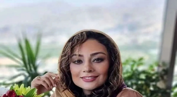 عکس قبل عمل یکتا ناصر