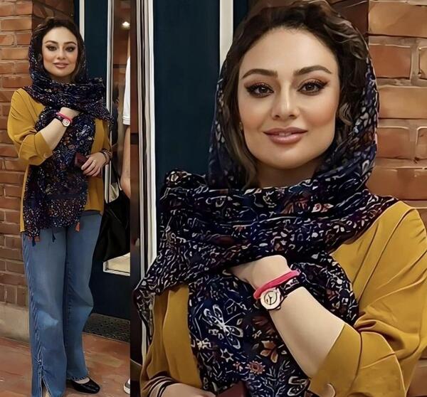 عکس قبل عمل یکتا ناصر