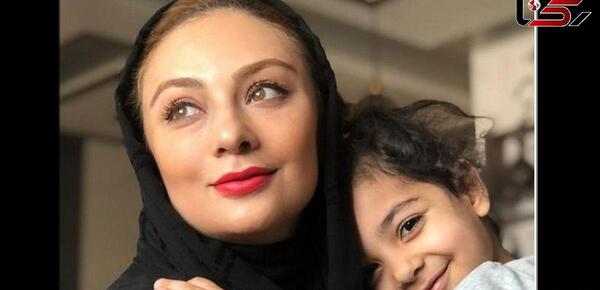 عکس یکتا ناصر قبل و بعد از عمل زیبایی