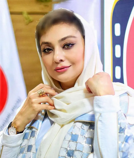 عکس یکتا ناصر قبل و بعد از عمل زیبایی