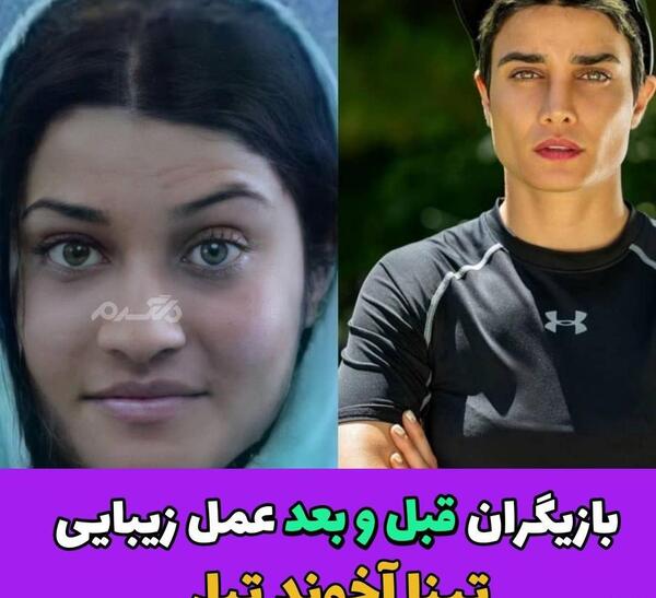 عکس قبل از عمل بینی کتایون ریاحی