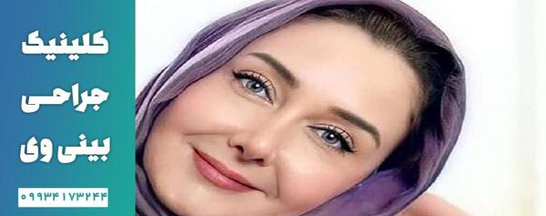 عکس قبل از عمل بینی کتایون ریاحی