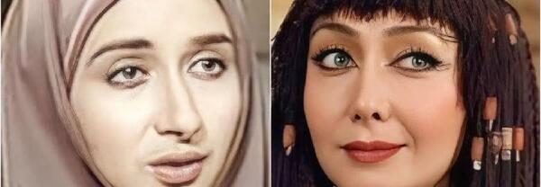 عکس قبل از عمل بینی کتایون ریاحی