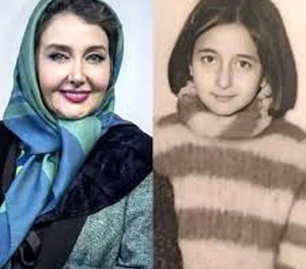 عکس قبل از عمل بینی کتایون ریاحی