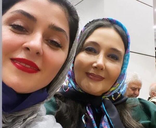 عکس قبل از عمل بینی کتایون ریاحی
