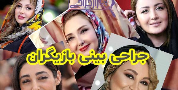 عکس قبل از عمل بینی کتایون ریاحی