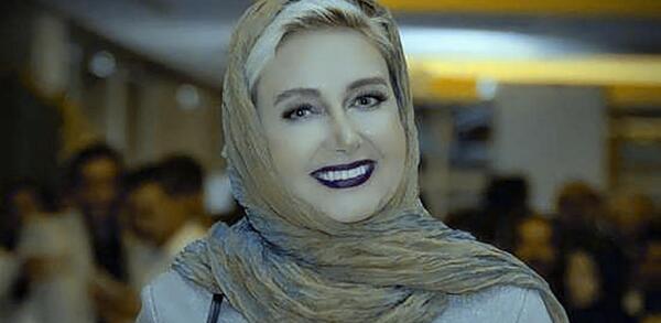 عکس قبل از عمل بینی کتایون ریاحی