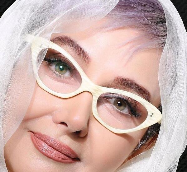 عکس قبل از عمل بینی کتایون ریاحی