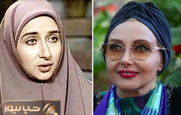 عکس قبل از عمل بینی کتایون ریاحی