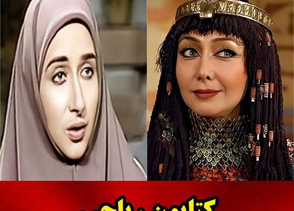 عکس قبل از عمل بینی کتایون ریاحی