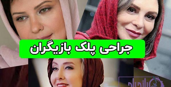 عکس قبل از عمل بینی کتایون ریاحی