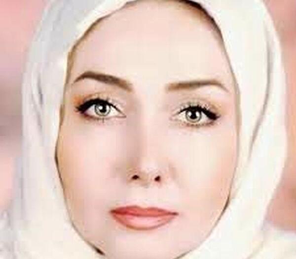 عکس قبل از عمل بینی کتایون ریاحی