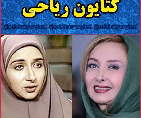 عکس کتایون ریاحی قبل از عمل دماغ