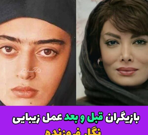 عکس کتایون ریاحی قبل از عمل دماغ
