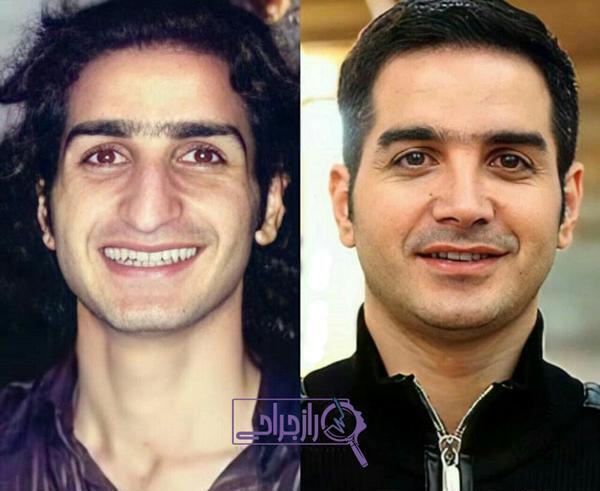 عکس کتایون ریاحی قبل از عمل دماغ