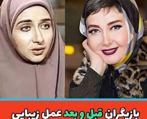عکس کتایون ریاحی قبل از عمل دماغ
