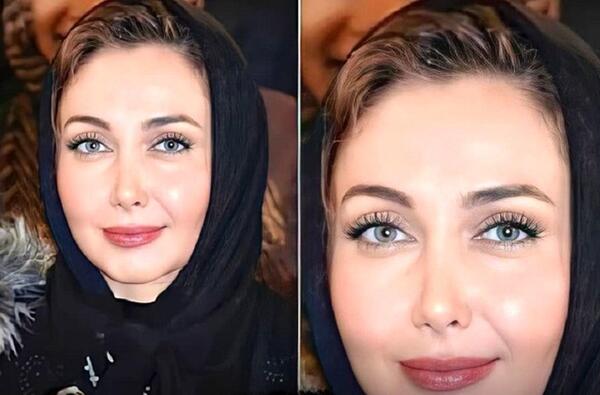 عکس کتایون ریاحی قبل از عمل دماغ