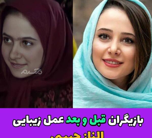 عکس کتایون ریاحی قبل از عمل دماغ