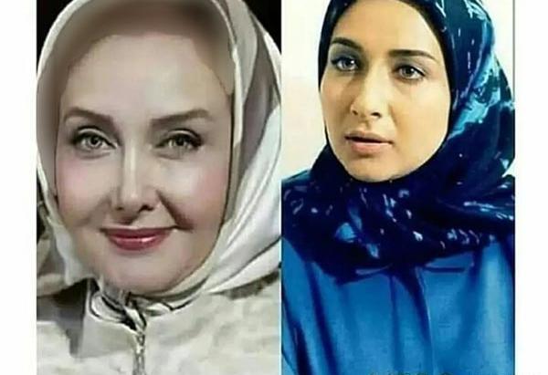 عکس کتایون ریاحی قبل از عمل دماغ