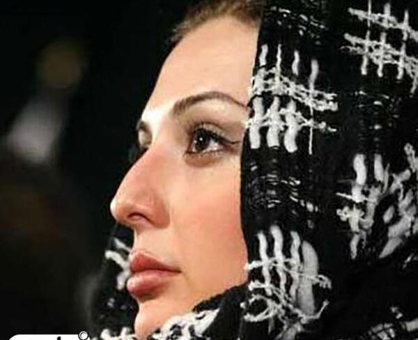 عکس های نیوشا ضیغمی قبل از عمل بینی
