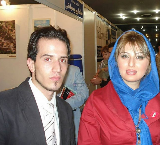 عکس های نیوشا ضیغمی قبل از عمل بینی