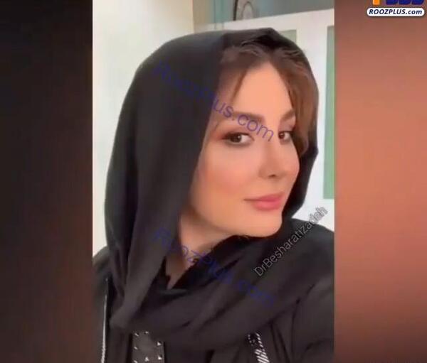 عکس های نیوشا ضیغمی قبل از عمل بینی
