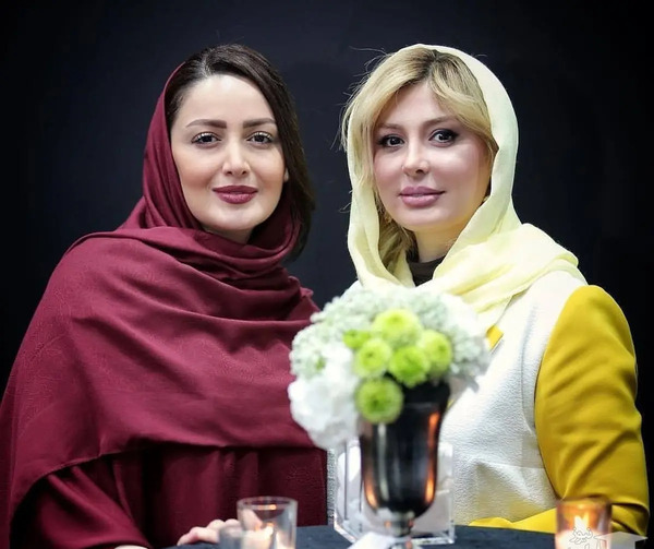 عکس های نیوشا ضیغمی قبل از عمل بینی