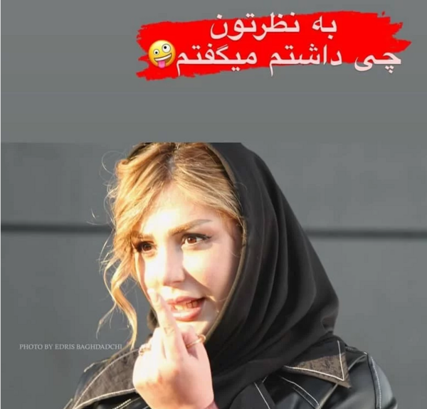عکس های نیوشا ضیغمی قبل از عمل بینی