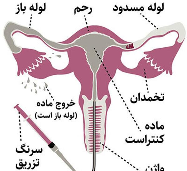 قبل عکس رنگی چه دارویی بخوریم