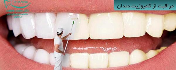 عکس کامپوزیت دندان قبل و بعد نی نی سایت