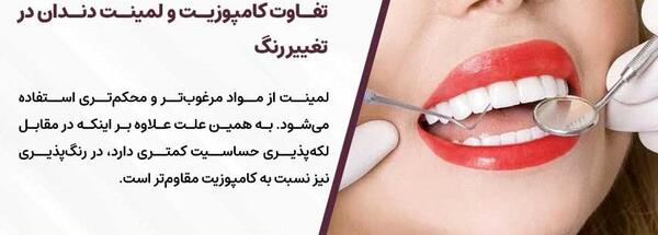 عکس کامپوزیت دندان قبل و بعد نی نی سایت
