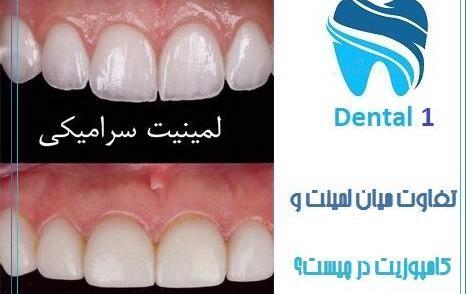 عکس کامپوزیت دندان قبل و بعد نی نی سایت