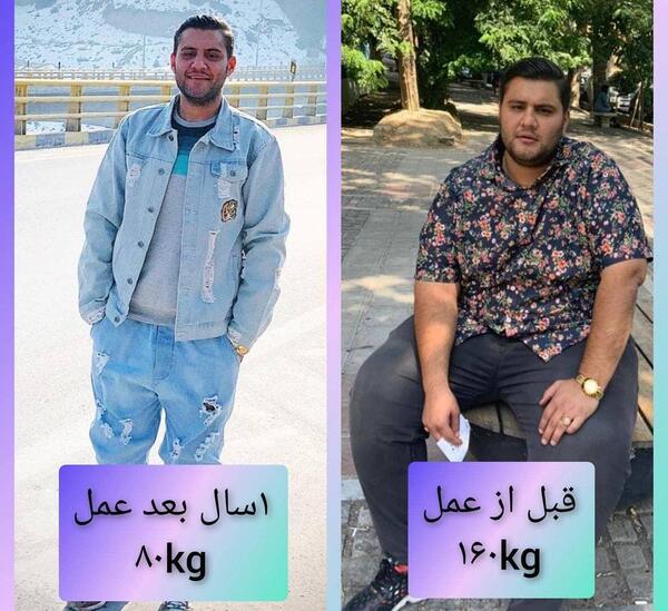 عکس قبل و بعد چاقی بدن