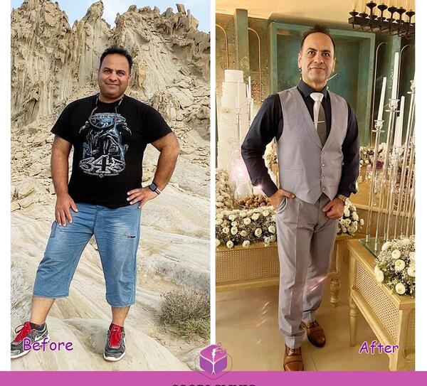 عکس قبل و بعد چاقی بدن