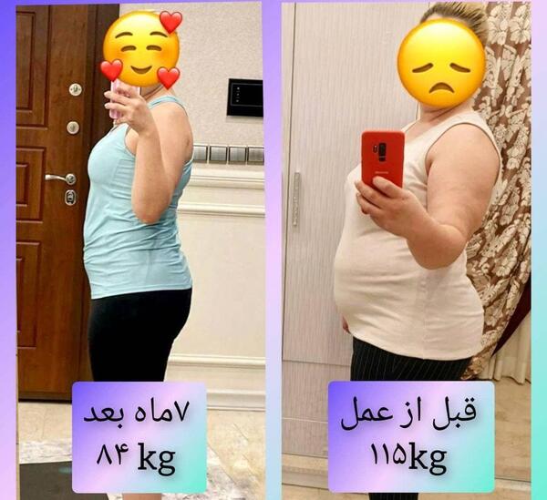 عکس قبل و بعد چاقی بدن