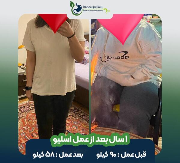عکس قبل و بعد چاقی بدن