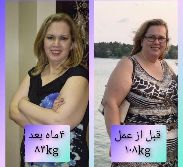 عکس قبل و بعد چاقی و لاغری ایرانی