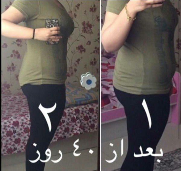 عکس قبل و بعد چاقی و لاغری ایرانی