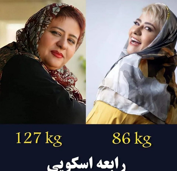عکس قبل و بعد چاقی و لاغری ایرانی