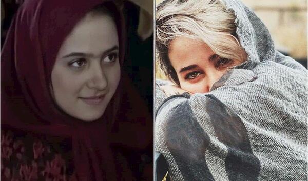 عکس های الناز حبیبی قبل از عمل