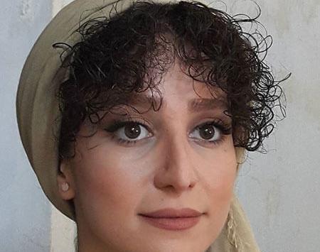 عکس های الناز حبیبی قبل از عمل