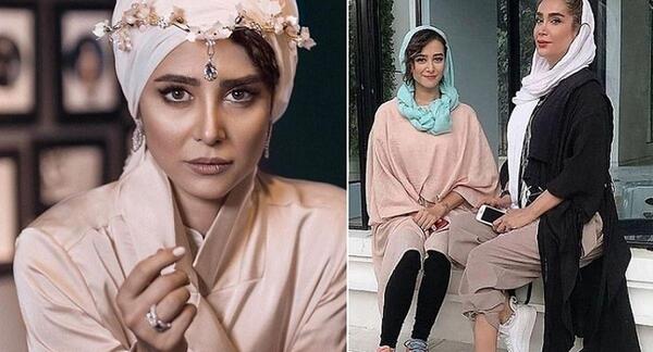 عکس های الناز حبیبی قبل از عمل