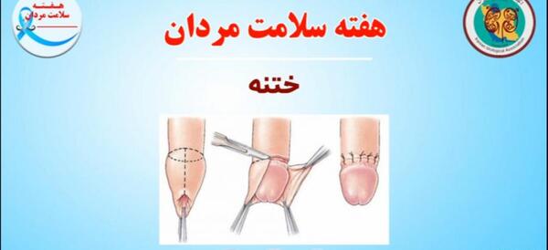 عکس قبل از ختنه