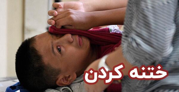 عکس قبل از ختنه