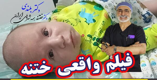 عکس قبل و بعد ختنه نوزاد