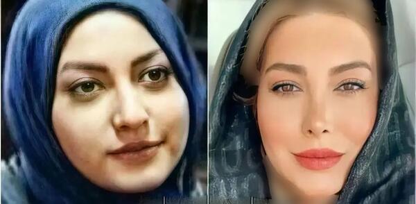 عکس حیات قبل از عمل زیبایی