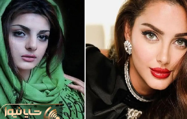 عکس حیات قبل از عمل زیبایی