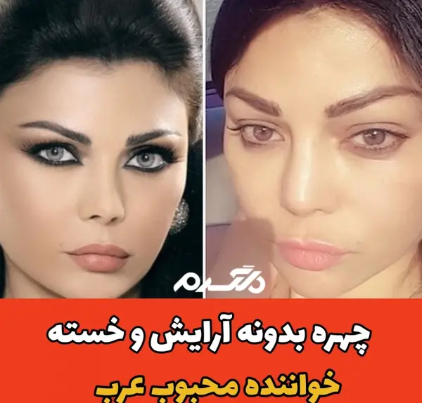 عکس های قبل عمل هیفا وهبی