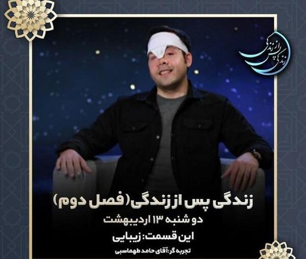 عکس قبل و بعد حامد طهماسبی