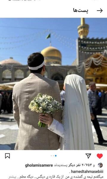 عکس قبل و بعد حامد طهماسبی